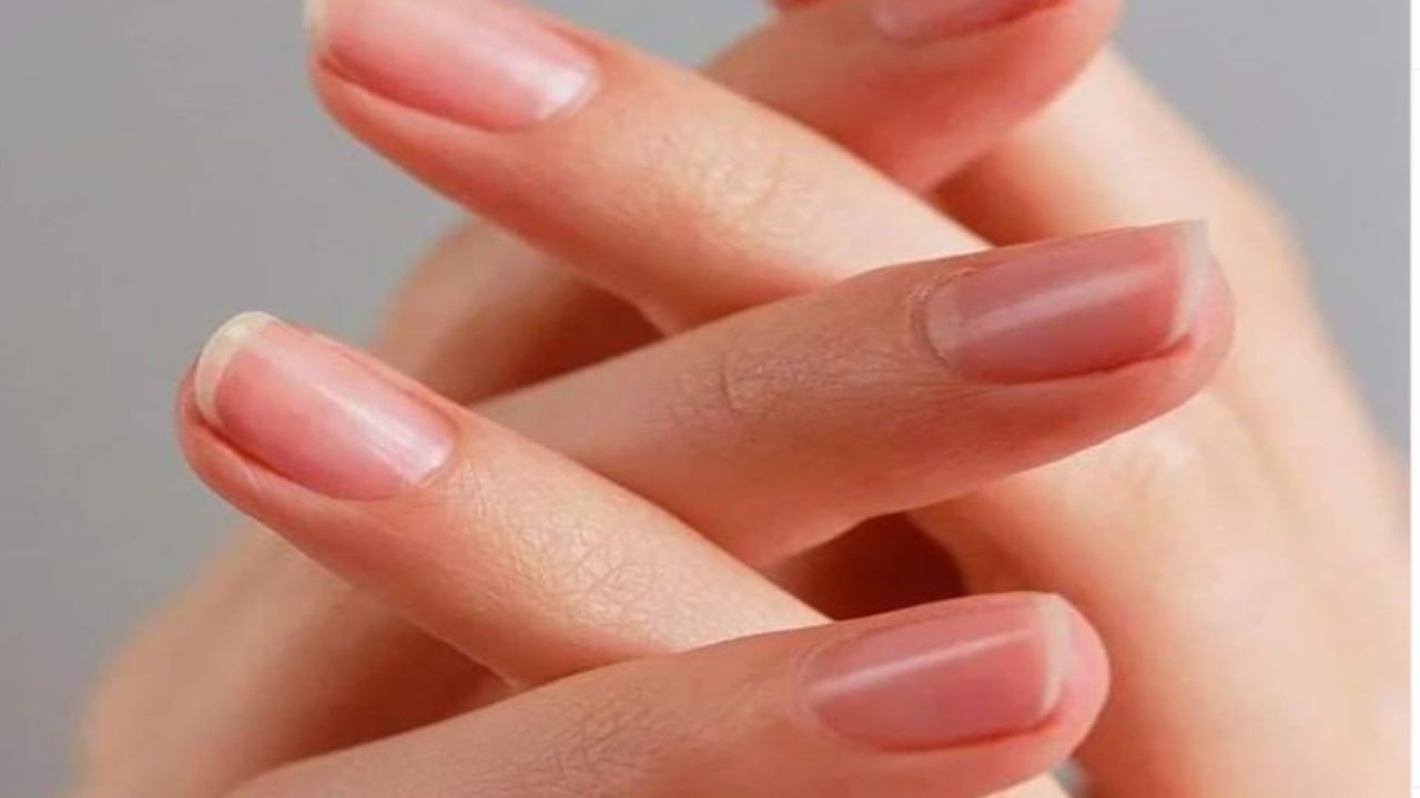Righe sulle unghie: le cause e i rimedi naturali più efficaci