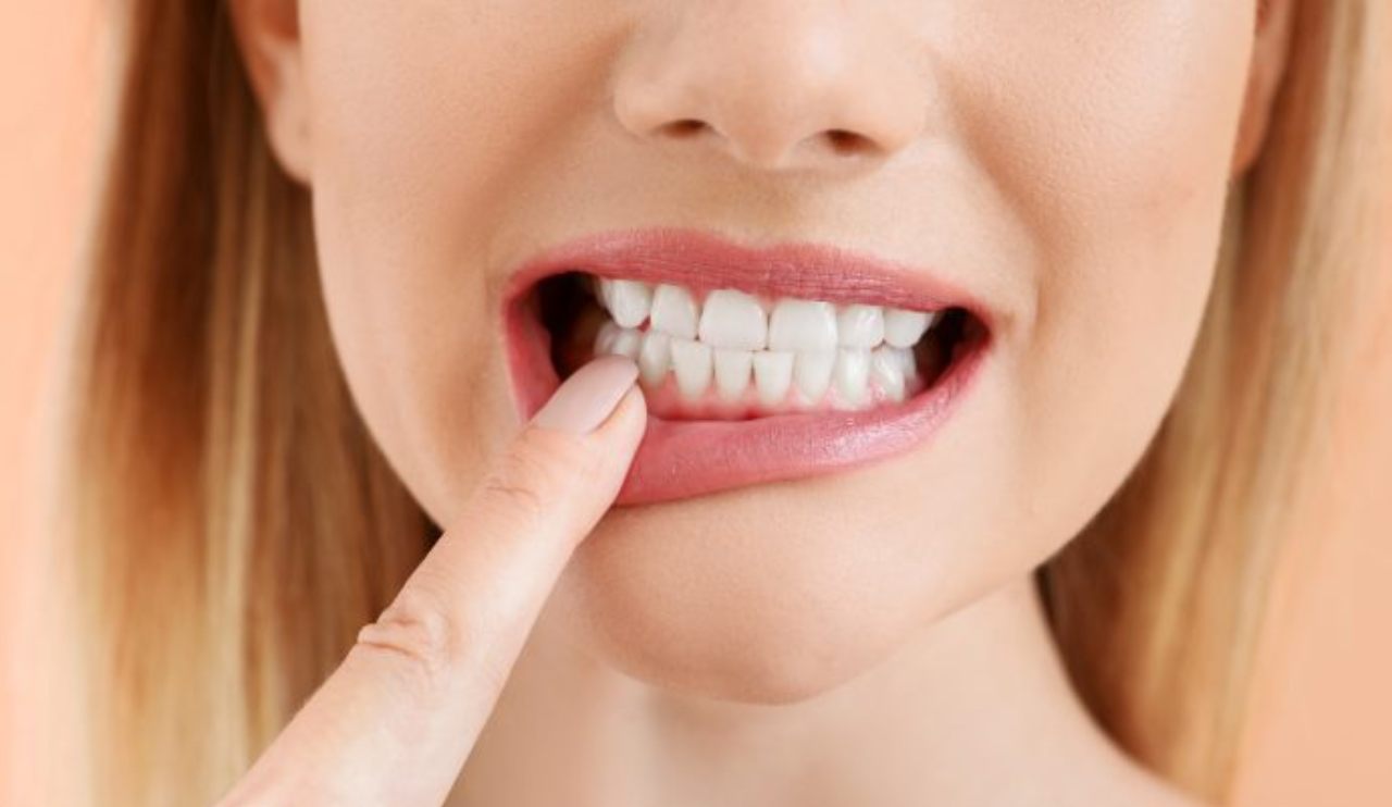 Afte della bocca: cosa sono e come eliminarle