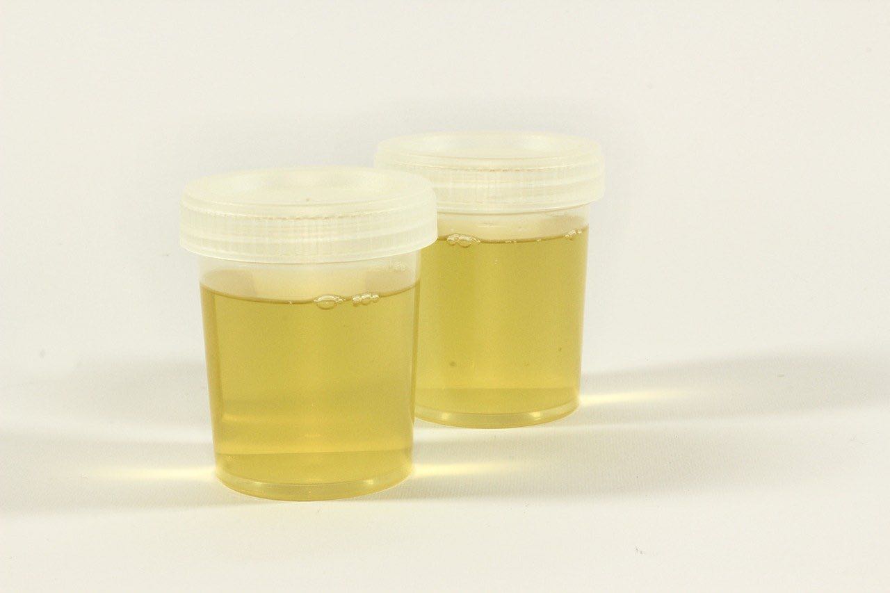 esami urine