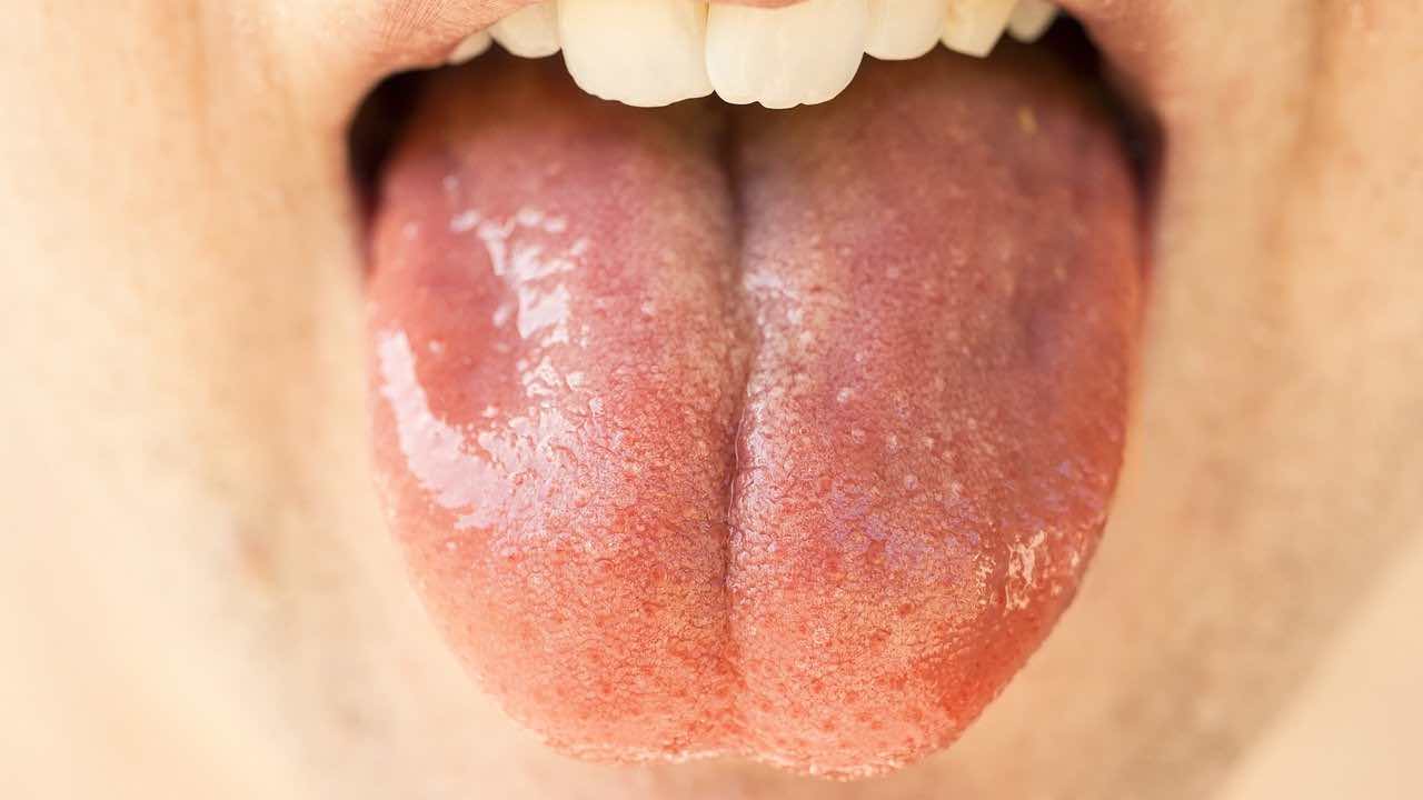 La lingua quando è sana