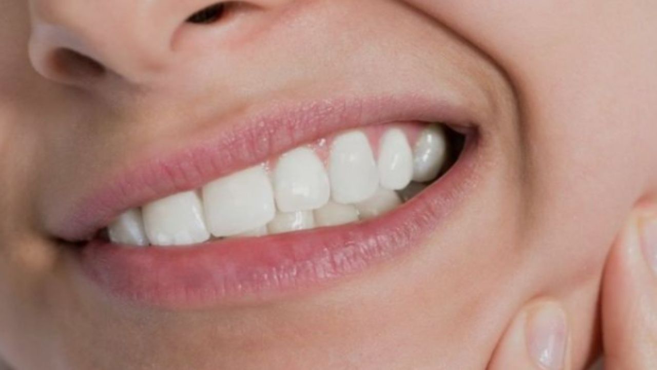 Denti del giudizio: a cosa servono e quando vanno estratti