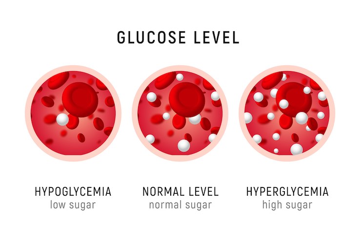 livello glucosio nel sangue