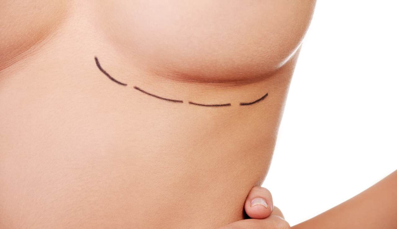 Lipofiller seno