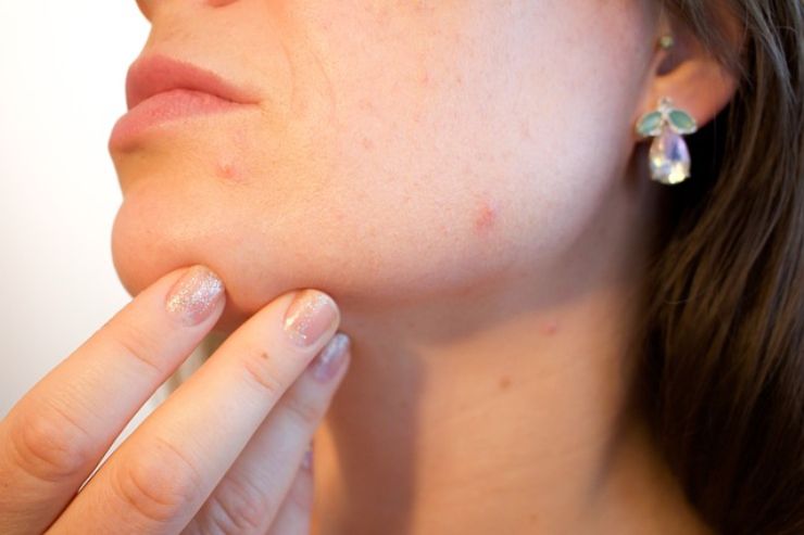 Esfoliazione pelle del viso: ecco perchè è importante