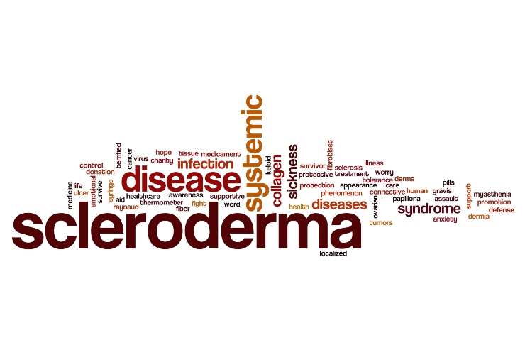 Sclerodermia molto diffusa, cosa è e come si tratta