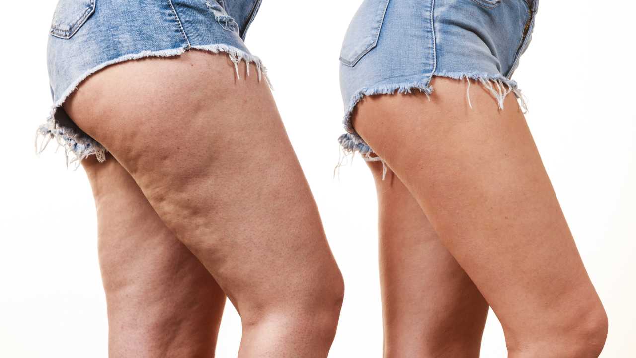 Cellulite pillola