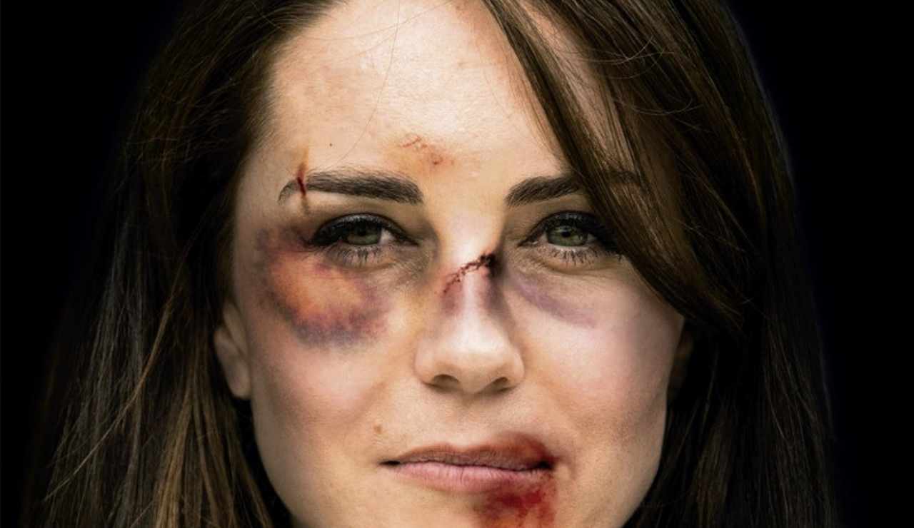 Kate Middleton violenza