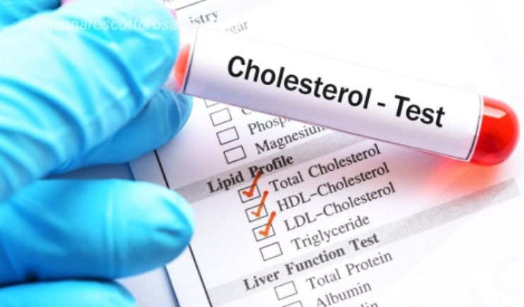 Perchè a gennaio il colesterolo è sempre più alto? Ecco le cause, i rimedi e gli esami da fare
