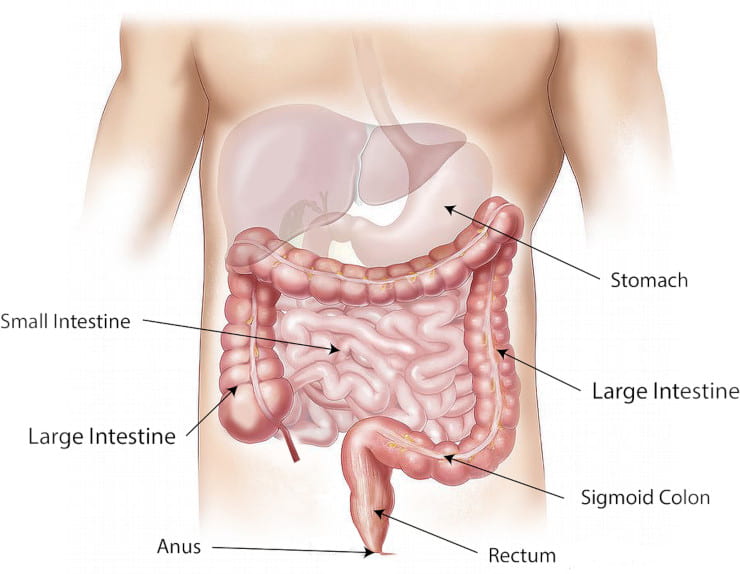 rettocolite ulcerosa morbo di crohn
