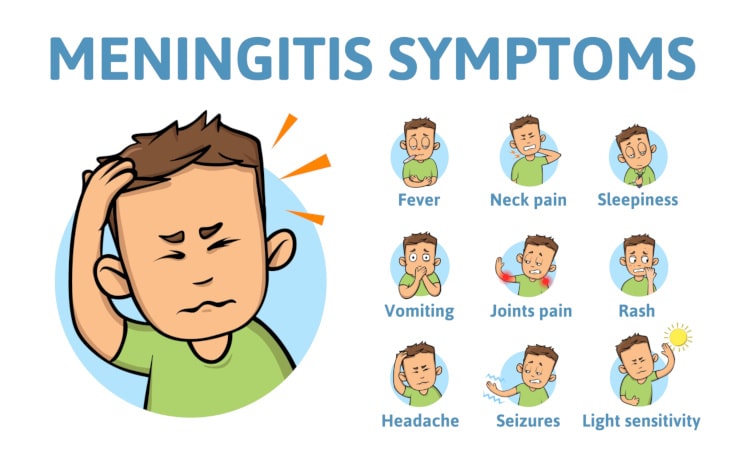 sintomi meningite