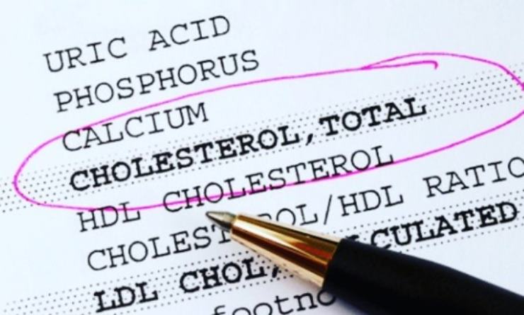 Tutti i tipi di colesterolo, hdl, ldl e totale cosa li differenzia
