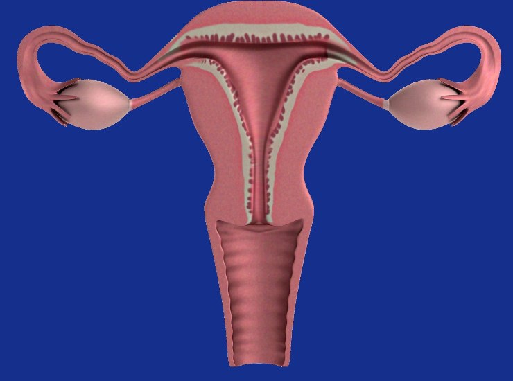 un comune ciclo mestruale potrebbe nascondere un cancro  alle ovaie, ecco come riconoscerlo
