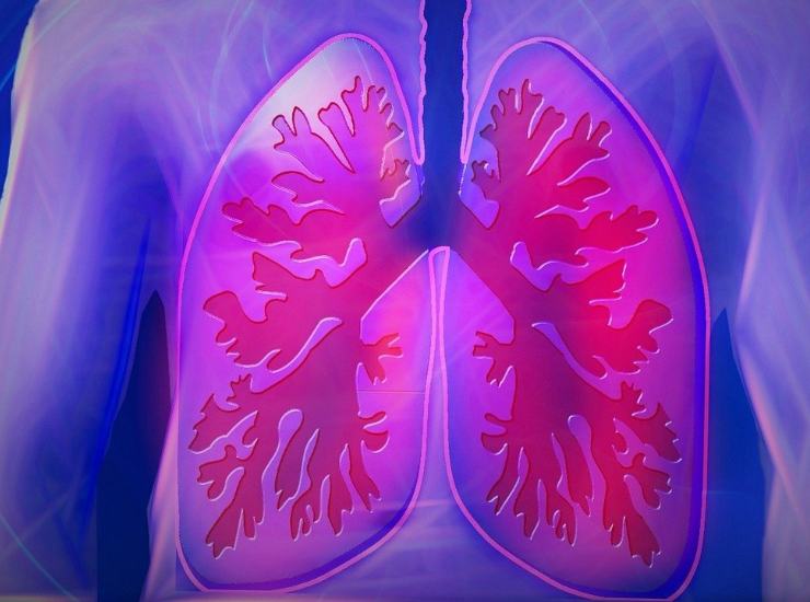 Hai un rischio alto di cancro ai polmoni? L'invenzione che lo calcola