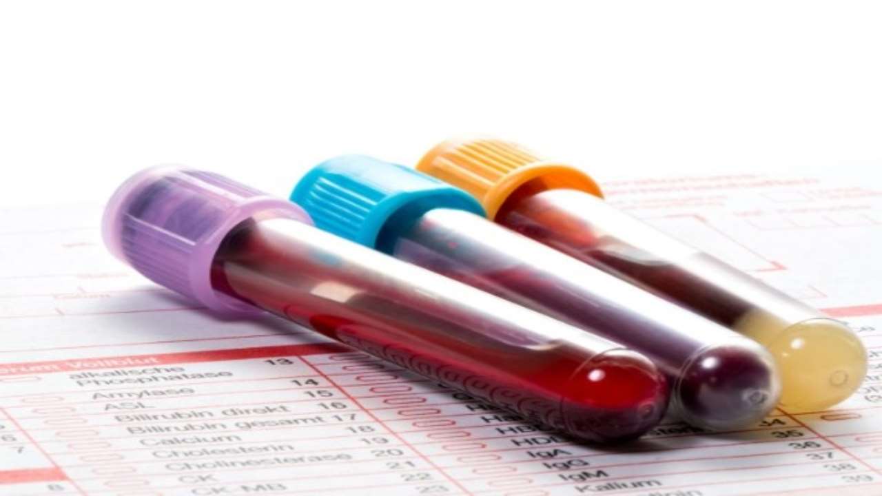 Devi fare le analisi del sangue a breve? Ecco come abbassare il colesterolo in pochissimo tempo