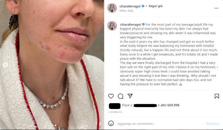 Chiara Ferragni Fedez confessione - NonSapeviChe