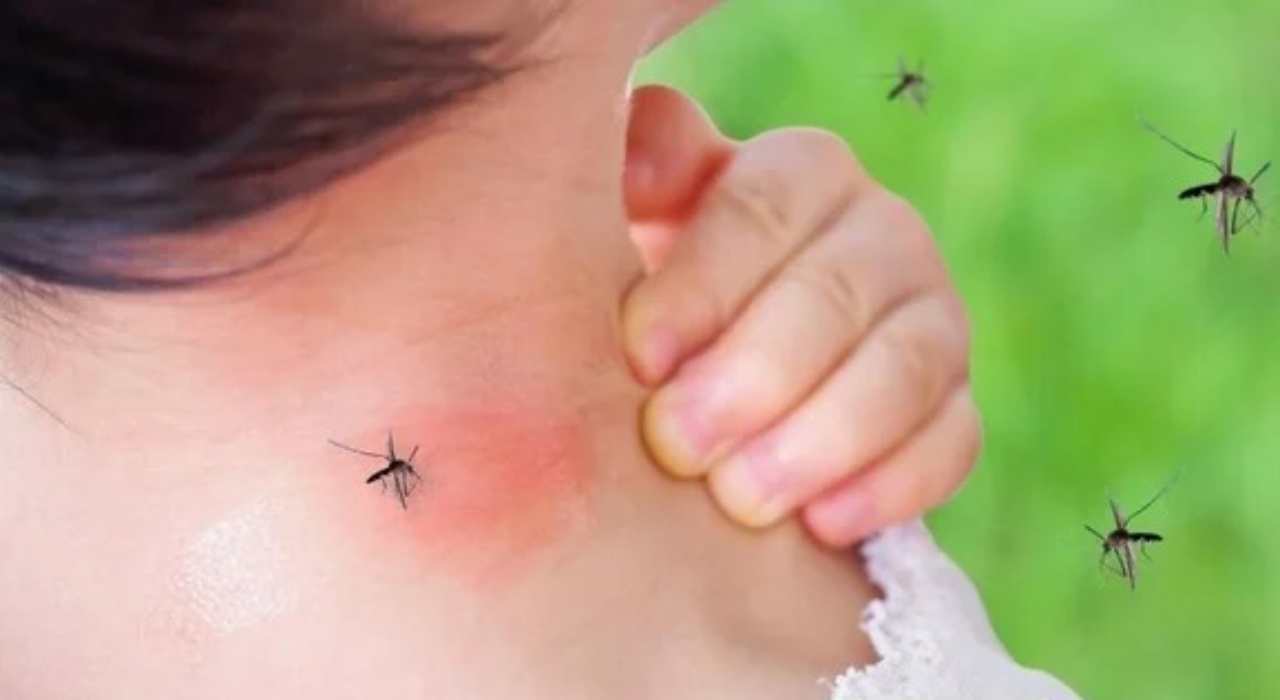 Puntura zanzara febbre - NonSapeviChe