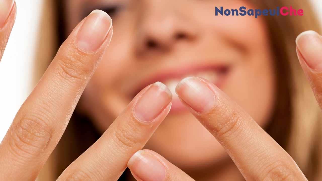 La forma e l'aspetto delle unghie dicono molto sulla tua salute: ecco cosa sapere