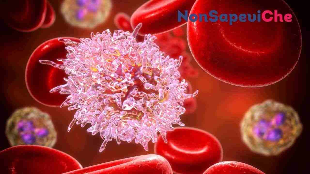 Leucemia, possiamo anticiparla e scoprirla, ecco la scoperta incredibile