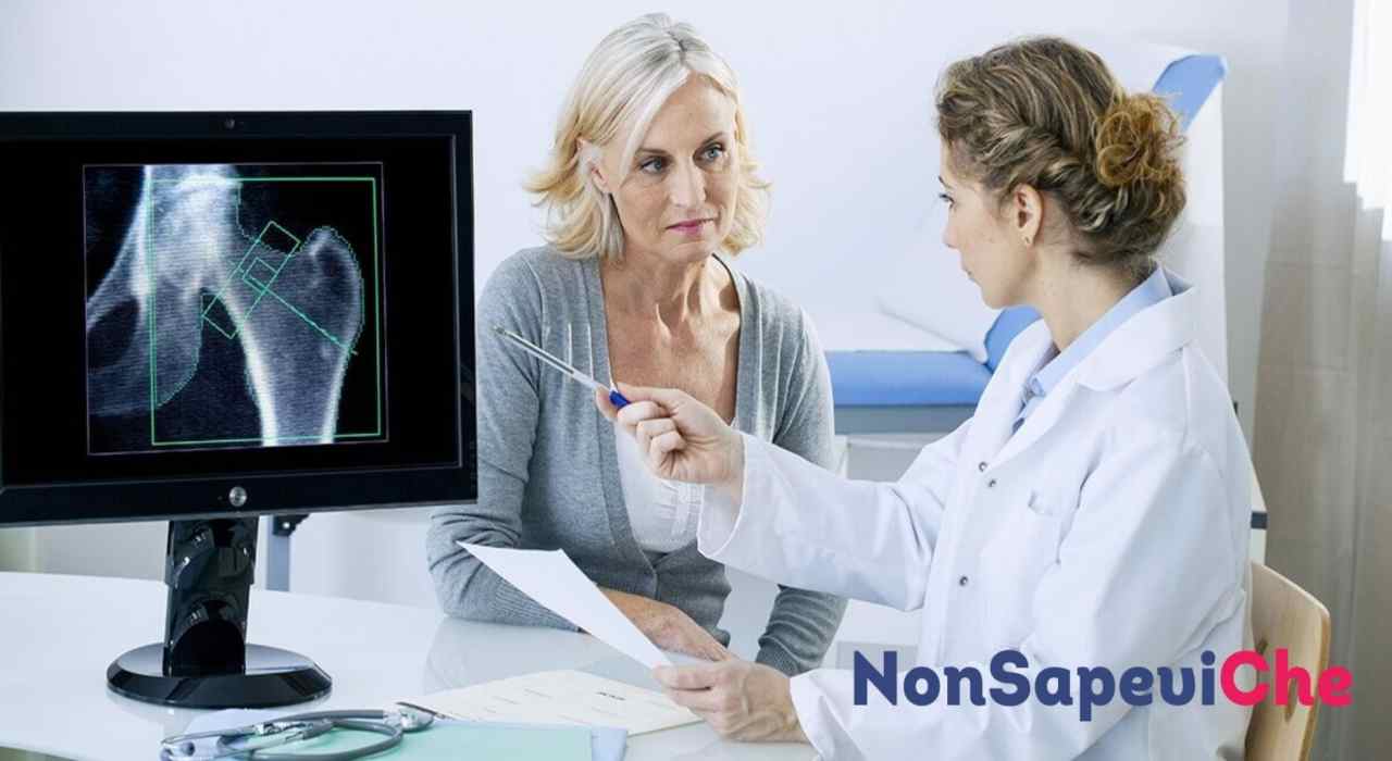 Prevenire osteoporosi - NonSapeviChe