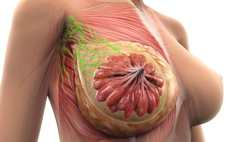 Tumore al seno scoperta come prevenirlo - NonSapeviChe