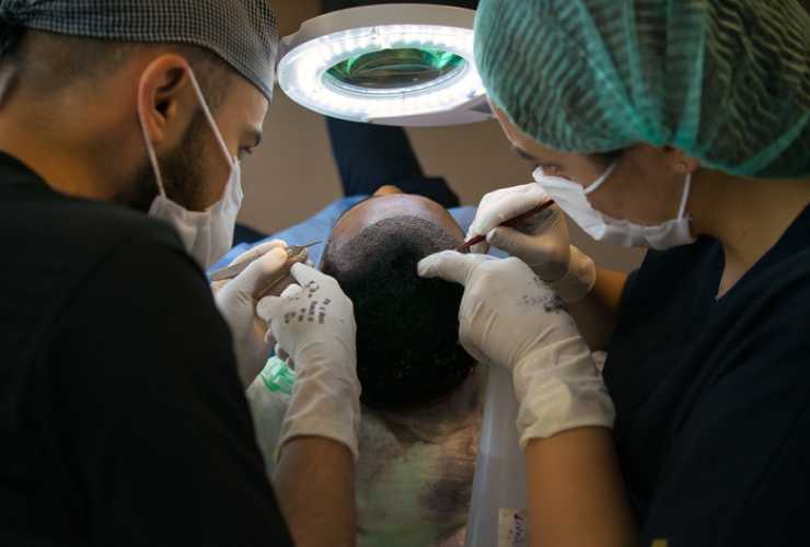 Trapianto capelli Italia o Turchia - NonSapeviChe